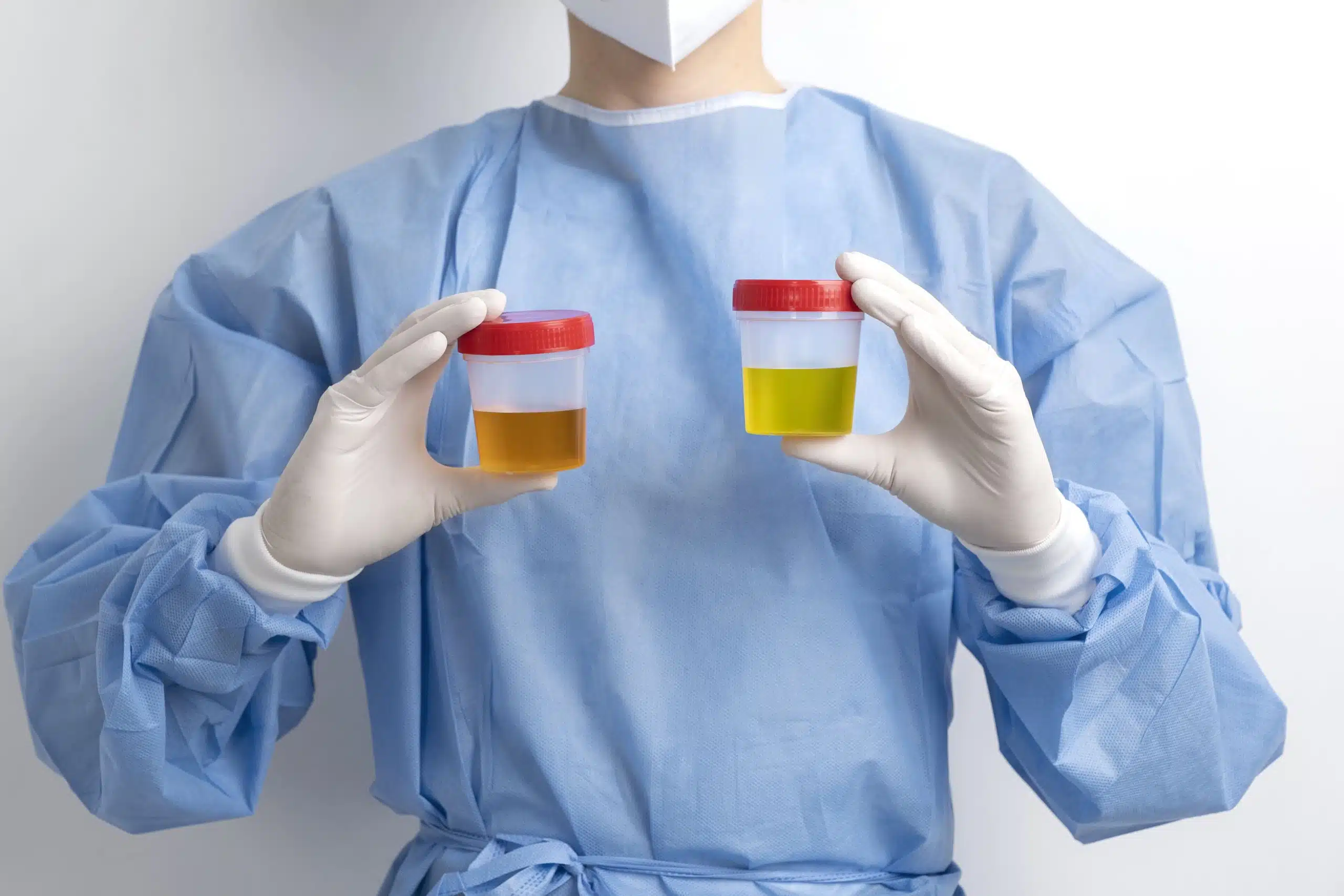 lab-doctor-performing-medical-exam-urine (2)