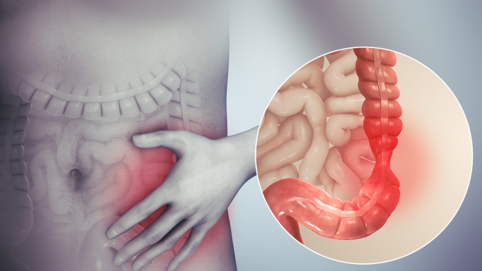 sindrome-do-intestino-irritavel-sii-o-que-e-e-como-lidar-com-essa-condicao-hepatogastro-bg-dcd-1536x864