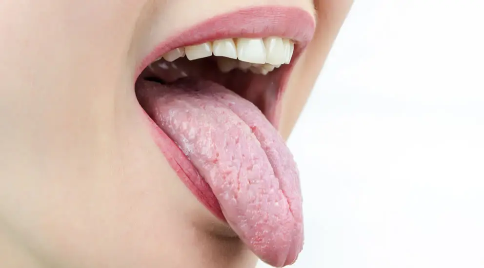 sindrome-de-sjogren